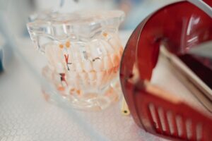 implantes dentales precio